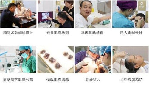 济南名韩植发手术流程