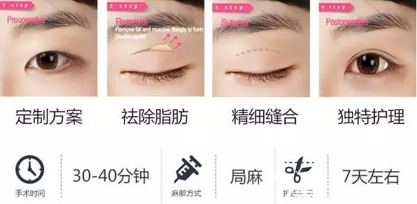 韩式双眼皮的手术过程和优势