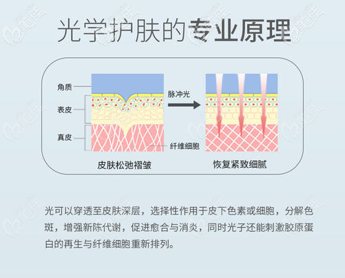 光学护肤的专业原理