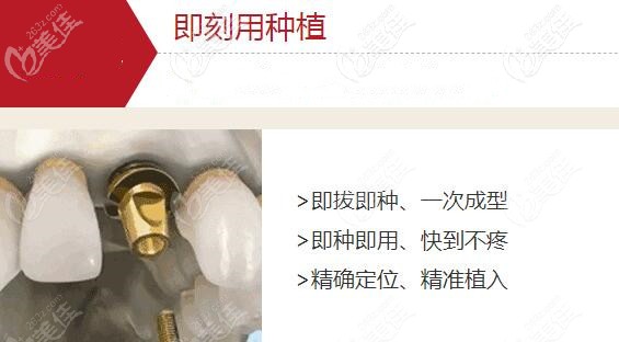 陈海滨医生介绍麦芽口腔全数字化即刻种植牙的优势