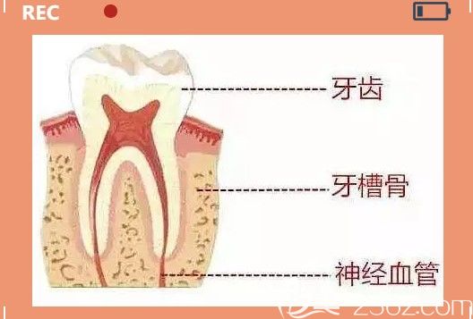 李满坡医生科普：牙槽骨吸收之后还可以补救吗.jpg