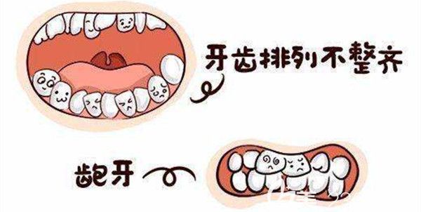 牙齿排列不整齐，出现龅牙等问题