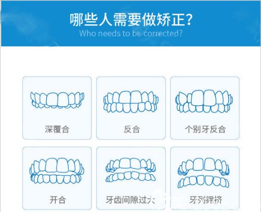 蔡灿医生告诉大家哪些人需要做矫正