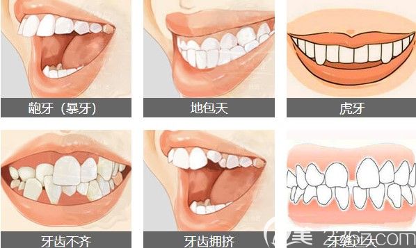 金巍特色技术易齐美4S正畸技术优势