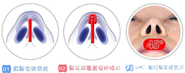 成都铜雀台整形美容医院真鼻子技术优势