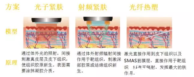 光纤热塑作用原理