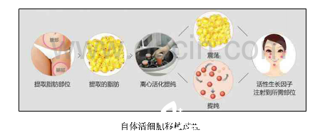 北京当代医疗美容门诊部自体脂肪填充过程图